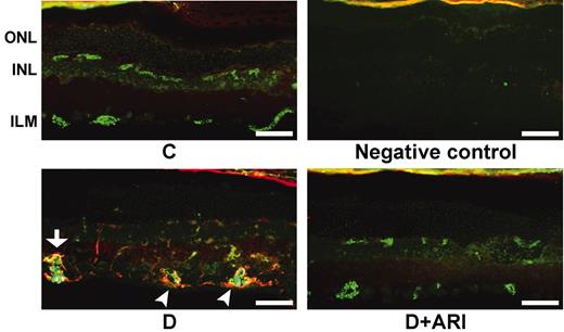 FIG. 6. Effect of ARI-809 on MAC deposition in the retina of diabetic rats. Retinal sections were immunostained for C5b-9 (MAC, red) and von Willebrand factor (green). In the retina of a diabetic rat, MAC is present along the inner limiting membrane and in the wall of vessels, at times peripheral to the endothelium (arrowheads) and at times colocalized with von Willebrand factor (yellow color, arrow). MAC is not detected in the retina of a diabetic rat treated with ARI-809. Bar = 50 μm. C, control rats; D, diabetic rats; D+ARI, diabetic rats treated with ARI-809; ILM, inner limiting membrane; INL, inner nuclear layer; ONL, outer nuclear layer.