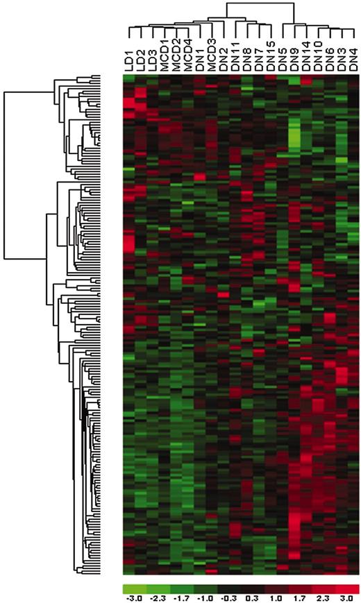 FIG. 4. NF-κB–dependant target molecules are significantly regulated in progressive DN. Of 232 NF-κB–dependant target genes, 138 (59.5%) showed mRNA expression above background in the kidney expression arrays. An unbiased cluster dendrogram using these 138 genes segregated progressive DN from the combined controls (MCD/LD) and early DN. Of the 138 expressed NF-κB–dependant mRNAs, 54 genes (39%) were significantly induced compared with the combined controls (LD/MCD). In contrast, only one of the 138 genes was upregulated in the early DN, underlining the role of NF-κB in the progression of DN.