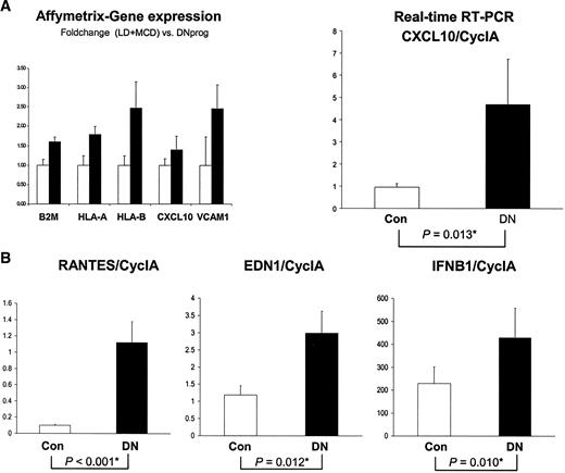 FIG. 5. Confirmation of predicted gene regulation by the NFKB_IRFF_01 promoter module. A: Microarray and real-time RT-PCR confirm the induction of B2M, HLA-A, HLA-B, VCAM1, and CXCL10/IP10 in progressive DN. B2M, HLA-A, HLA-B, VCAM1, and CXCL10/IP10 expression levels in progressive DN extracted from the array studies are given as ratios to the combined control group (LD/MCD) in the left panel. For confirmation and validation of the hybridization experiments, mRNA expression for CXCL10/IP10 was studied in a cohort of progressive DN patients (n = 22) and different control subjects (LD, n = 9; CD, n = 1; and MCD, n = 7) using real-time RT-PCR (right panel). mRNA expression ratios were normalized to Cyclophilin A. Comparable with the array data (left panel) CXCL10/IP10 mRNA was induced in the tubulointerstitium of patients with advanced DN (DN vs. control, P = 0.013*). Con, control. B: mRNA expression for CCL5/RANTES, EDN1, and IFNB1 is significantly induced in patients with progressive DN. mRNA expression for CCL5/RANTES, EDN1, and IFNB1 was studied in a cohort of progressive DN patients (n = 22) and different control subjects (n = 17) by real-time RT-PCR. mRNA expression ratios normalized to Cyclophilin A revealed a significant induction in the tubulointerstitium of patients with advanced DN (CCL5/RANTES: DN vs. control, *P < 0.001; EDN1: DN vs. control, *P = 0.012; IFNB1: DN vs. control, *P = 0.010*). Con, control.