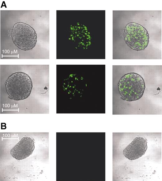 FIG. 1. Fluorescence of GFP-tagged KATP channels in islets from transgenic mice. Representative clear field and fluorescent confocal images of isolated islets from an adult Kir6.2[ΔN2-30] transgene mouse (A) and a control littermate mouse (B). Kir6.2[ΔN2-30] transgene mouse: age 11 months, random blood glucose 170 mg/dl; control mouse: age 11 months, random blood glucose 127 mg/dl.