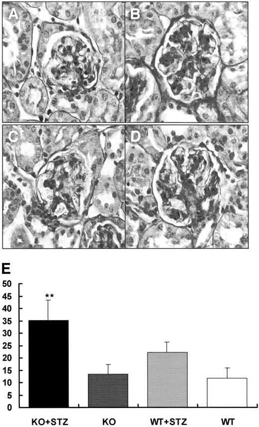 FIG. 3. Renal histopathology in normal and diabetic PPARα wild-type (WT) and knockout (KO) mice. A representative photomicrograph of mesangial matrix accumulation in periodic acid Schiff–stained nondiabetic (A and C) and diabetic PPARα wild-type and knockout (B and D) kidneys, respectively. E: Quantitative assessment (%) of mesangial matrix fraction in diabetic and nondiabetic PPARα wild-type and knockout kidneys. Statistical significance was calculated using Mann-Whitney test. **P < 0.01 vs. diabetic PPARα wild-type mice and nondiabetic PPARα wild-type and knockout mice. STZ, streptozotocin.