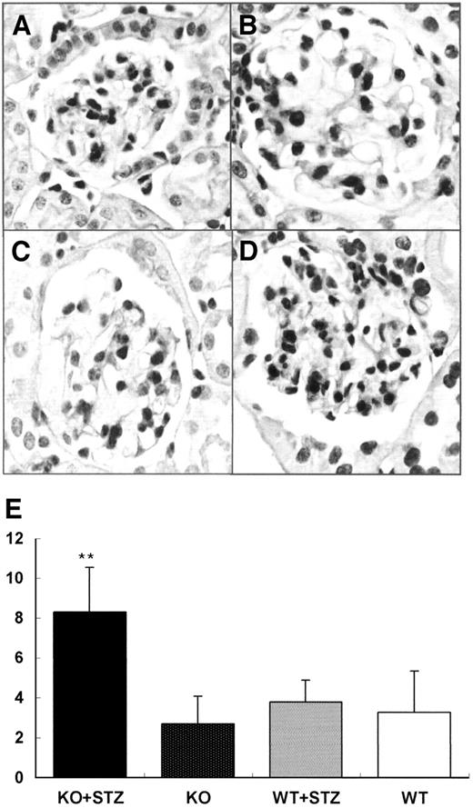 FIG. 5. TUNEL staining in mesanigal areas in nondiabetic (A and C) and diabetic (B and D) PPARα wild-type (WT) and knockout (KO) cortical kidneys. Increased number of TUNEL-positive cells were seen in diabetic PPARα knockout mice (D). E: Number of TUNEL-positive cells per glomerulus in diabetic and nondiabetic PPARα wild-type and knockout kidneys. **P < 0.01 vs. diabetic PPARα wild-type and nondiabetic PPARα wild-type and knockout mice. STZ, streptozotocin.
