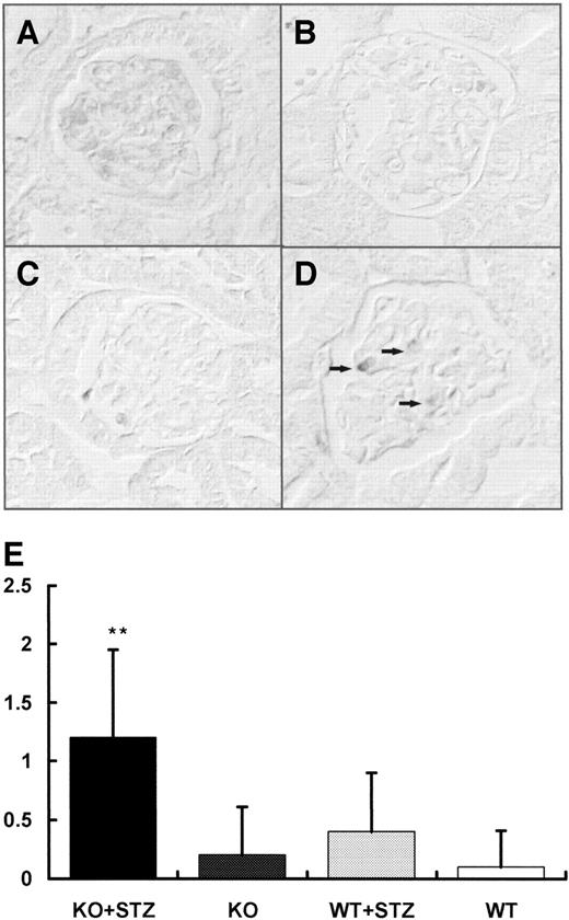 FIG. 6. Immunohistochemical staining for caspase-3 in cortical glomeruli. Immunoreactivity for caspase-3 and representative pictures (A–D) expression in nondiabetic (A and C) and diabetic (B and D) PPARα wild-type (WT) and knockout (KO) cortical kidneys. Increased caspase-3 expression was seen in diabetic PPARα knockout mice. E: Number of caspase-3–positive cells per glomerulus in diabetic and nondiabetic PPARα kidneys. Statistical significance was calculated using Mann-Whitney test. **P < 0.001 vs. diabetic PPARα wild-type mice and nondiabetic PPARα wild-type and knockout mice. STZ, streptozotocin.