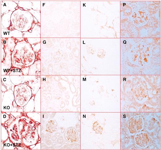 FIG. 4. Immunohistochemical staining for type IV collagen, TGF-β, osteopontin, and F4/80 in kidney cortical glomeruli. Representative immunostains for type IV collagen (A–D), TGF-β (F–I), osteopontin (K–N), and F4/80 (P–S) in diabetic and nondiabetic PPARα wild-type and knockout kidneys. Quantitative assessment of type IV collagen (E), TGF-β (J), osteopontin (O), and F4/80 (T) immunoreactivity in diabetic and nondiabetic PPARα wild-type and knockout kidneys. Statistical significance was calculated using Mann-Whitney test. *P < 0.05, **P < 0.01 compared with other groups. STZ, streptozotocin.