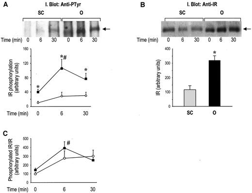 FIG. 2. Insulin receptor (IR) tyrosine phosphorylation and total protein content in human subcutaneous (SC) and omental (O) fat. Paired biopsies from subcutaneous (○) and omental (▪) fat were obtained in the basal state and 6 and 30 min following administration of 0.1 unit/kg regular insulin i.v. Equal amounts of solubilized tissue proteins were analyzed by immunoblotting with anti-phosphotyrosine (PTyr) or anti–insulin receptor antibodies, as indicated. In each panel, a representative experiment and the quantitation of results from the experimental subjects are shown. A: Tyrosine phosphorylation of the insulin receptor β-subunit (n = 5). B: Insulin receptor protein content (data from basal and insulin-stimulated samples of each fat depot pooled together) (n = 6). C: Ratio of tyrosine phosphorylated to total insulin receptor in the individual samples. *P < 0.05 vs. subcutaneous; #P < 0.05 vs. basal (time 0 min).