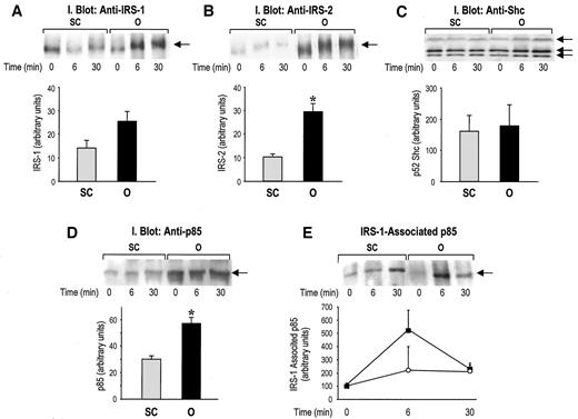 FIG. 3. IRS-1, IRS-2, p85, and Shc protein content in human subcutaneous (SC) and omental (O) fat. Paired biopsies from subcutaneous (○) and omental (▪) fat were obtained in the basal state and 6 and 30 min following administration of 0.1 unit/kg regular insulin i.v. Equal amounts of solubilized tissue proteins were analyzed by immunoblotting with anti–IRS-1, anti–IRS-2, anti-p85, or anti-Shc antibodies, respectively. In each panel, a representative experiment and the quantitation of results from all experimental subjects are shown. A: IRS-1 protein content (n = 6). B: IRS-2 protein content (n = 7). C: Shc protein content and quantitation of the p52Shc isoform (n = 6). D: p85 protein content (n = 4). To quantitate the total content of these proteins, data from basal and insulin-stimulated samples of each fat depot were pooled. E: IRS-1–associated p85. Equal amounts of solubilized tissue proteins were immunoprecipitated with anti–IRS-1 antibodies and analyzed by immunoblotting with anti-p85 antibodies (n = 4). *P < 0.05 vs. subcutaneous.