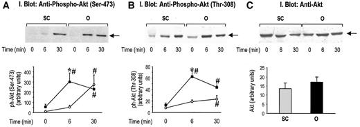 FIG. 4. Akt phosphorylation and total Akt protein content in human subcutaneous (SC) and omental (O) fat. Solubilized proteins from subcutaneous (○) and omental (▪) fat depots were resolved by 10% SDS-PAGE and analyzed by immunoblotting with anti–phospho-Akt (Ser-473), anti–phospho-Akt (Thr-308), or anti-Akt antibodies, as described in research design and methods. A and B: Representative immunoblots and the quantitation of Akt phosphorylation on Ser-473 and Thr-308, respectively (n = 6). C: Total Akt protein content (n = 6) (values of basal and insulin-stimulated samples pooled together). *P < 0.05 vs. SC; #P < 0.05 vs. basal (time 0 min).