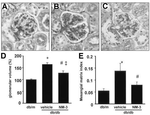FIG. 2. A–C: Representative light microscopic appearance of glomeruli (periodic acid Schiff staining; original magnification ×400) for db/m mice (A), db/db mice treated with vehicle buffer (B), and db/db mice treated with NM-3 (C) at 16 weeks of age. D: Increase of glomerular volume in db/db mice was diminished by treatment with NM-3. Glomerular volume was determined as described in research design and methods. *P < 0.05 vs. db/m; #P < 0.05 vs. vehicle. E: Mesangial matrix index was defined as the proportion of the glomerular tuft occupied by the mesangial matrix area (excluding nuclei). *P < 0.05 vs. db/m; #P < 0.05 vs. vehicle. n = 6 for each group. Vehicle, db/db mice treated with vehicle buffer; NM-3, db/db mice treated with NM-3. Each column consists of means ± SE.
