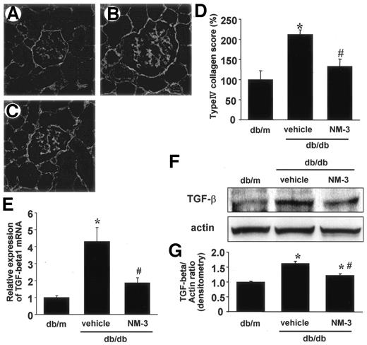 FIG. 3. Glomerular accumulation of type IV collagen was assessed by indirect immunofluorescence method as described in research design and methods for db/m mice (A), db/db mice treated with vehicle buffer (B), and db/db mice treated with NM-3 (C) at 16 weeks of age. A–C: Original magnification ×400. D: The amount of immunoreactive type IV collagen in glomeruli relative to nondiabetic control db/m mice determined by NIH Image is shown; n = 6 for each group. Vehicle, db/db mice treated with vehicle buffer; NM-3, db/db mice treated with NM-3. *P < 0.001 vs. db/m; #P < 0.01 vs. vehicle. E: Expression of TGF-β1 mRNA detected by real-time PCR. Total RNA was extracted from kidney cortex and subjected to the examination using quantitative real-time PCR as described in research design and methods. The amount of TGF-β1 mRNA relative to 18s rRNA is shown. Results were expressed relative to db/m mice that were arbitrarily assigned a value of 1.0. n = 5 for each group. *P < 0.01 vs. db/m; #P < 0.05 vs. vehicle. F: Immunoblots for TGF-β and actin are shown. In each lane, 50 mg protein obtained from kidney cortex was loaded. Each band was scanned and subjected to densitometry. G: Intensities of TGF-β protein relative to actin are shown. *P < 0.05 vs. db/m; #P < 0.005 vs. vehicle. Each column consists of means ± SE.