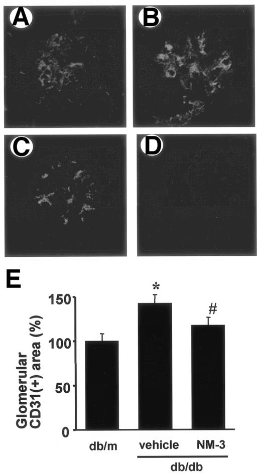FIG. 4. Immunofluorescent staining of CD31, an endothelial cell marker. Distribution of CD31 was determined by indirect immunofluorescence method as described in research design and methods for db/m mice (A), db/db mice treated with vehicle buffer (B), and db/db mice treated with NM-3 (C) at 16 weeks of age. D: No immunoreactivity was observed in sections (db/db mice treated with vehicle buffer) incubated with normal IgG in place of primary antibody. E: Glomerular CD31+ endothelial area was quantitated as described in research design and methods. Increase in CD31+ glomerular capillary area was significantly suppressed after treatment with NM-3. n = 6 for each group. Vehicle, db/db mice treated with vehicle buffer; NM-3, db/db mice treated with NM-3. *P < 0.01 vs. db/m; #P < 0.05 vs. vehicle. Each column consists of means ± SE.