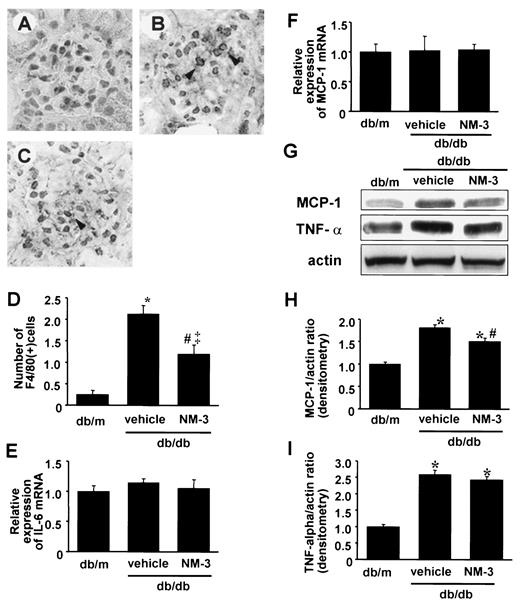 FIG. 5. Immunohistochemistry of F4/80+ monocyte/macrophage. Distribution of F4/80+ cells was determined by indirect immunohistochemistry for db/m mice (A), db/db mice treated with vehicle buffer (B), and db/db mice treated with NM-3 (C) at 16 weeks of age. F4/80+ cells were observed in diabetic mice (arrowheads) and in diabetic mice treated with NM-3 to a lesser extent. Representative light microscopic appearance of glomerulus is shown (original magnification ×400). D: The number of glomerular F4/80+ monocyte/macrophage is shown. Increase in F4/80+ monocyte/macrophage number was significantly suppressed after treatment with NM-3; n = 6 for each group. Vehicle, db/db mice treated with vehicle buffer; NM-3, db/db mice treated with NM-3. *P < 0.001 vs. db/m; #P < 0.01 vs. vehicle; ‡P < 0.01 vs. db/m. E: Expression of IL-6 mRNA detected by real-time PCR. Total RNA was extracted from kidney cortex and subjected to quantitative real-time PCR. The amount of IL-6 mRNA relative to 18s rRNA is shown. Results were expressed relative to db/m mice that were arbitrarily assigned a value of 1.0. n = 5 for each group. F: Expression of MCP-1 mRNA detected by real-time PCR. The amount of MCP-1 mRNA relative to 18s rRNA is shown. Results were expressed relative to db/m mice that were arbitrarily assigned a value of 1.0. n = 5 for each group. G: Immunoblots for MCP-1, TNF-α, and actin are shown. In each lane, 50 μg protein obtained from kidney cortex was loaded. Each band was scanned and subjected to densitometry. H: Intensities of MCP-1 protein relative to actin are shown. *P < 0.005 vs. db/m; #P < 0.05 vs. vehicle. I: Intensities of TNF-α protein relative to actin are shown. *P < 0.001 vs. db/m. Vehicle, db/db mice treated with vehicle buffer; NM-3, db/db mice treated with NM-3. n = 5 for each group. Each column consists of means ± SE.