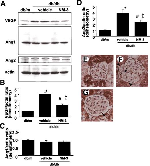 FIG. 6. A–D: Immunoblot analysis. A: Immunoblots for VEGF-A, Ang-1, Ang-2, and actin are shown. In each lane, 50 μg protein obtained from kidney cortex was loaded. Each band was scanned and subjected to densitometry. B: Intensities of VEGF-A protein relative to actin are shown. *P < 0.02 vs. db/m; #P < 0.05 vs. vehicle; ‡P < 0.05 vs. db/m. C: Intensities of Ang-1 protein relative to actin are shown. D: Intensities of Ang-2 protein relative to actin are shown. *P < 0.05 vs. db/m; #P < 0.05 vs. vehicle; ‡P < 0.05 vs. db/m. Vehicle, db/db mice treated with vehicle buffer; NM-3, db/db mice treated with NM-3. n = 5 for each group. E–G: Immunohistochemistry of VEGF-A. Distribution of VEGF-A was examined by indirect immunohistochemistry for db/m mice (E), db/db mice treated with vehicle buffer (F), and db/db mice treated with NM-3 (G) at 16 weeks of age. F: Increased immunoreactivity for VEGF-A was mainly localized to glomerular podocytes (arrowheads) in vehicle-treated diabetic mice. G: Immunoreactivity for VEGF-A was observed to a lesser extent in diabetic mice treated with NM-3.
