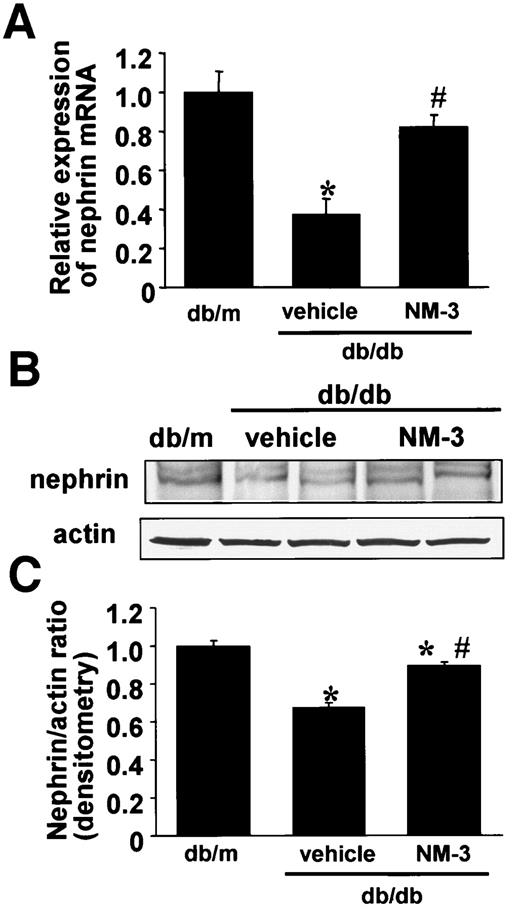 FIG. 7. A: Expression of nephrin mRNA detected by real-time PCR. Total RNA was extracted from kidney cortex and subjected to quantitative real-time PCR as described in research design and methods. The amount of nephrin mRNA relative to 18s rRNA is shown. Results were expressed relative to db/m mice that were arbitrarily assigned a value of 1.0. Vehicle, db/db mice treated with vehicle buffer; NM-3, db/db mice treated with NM-3. n = 5 for each group. *P < 0.005 vs. db/m; #P < 0.01 vs. vehicle. B and C: Immunoblot analysis of nephrin. B: Immunoblots for nephrin and actin are shown. In each lane, 50 μg protein obtained from kidney cortex was loaded. Each band was scanned and subjected to densitometry. C: Intensities of nephrin protein relative to actin are shown. *P < 0.05 vs. db/m; #P < 0.001 vs. vehicle. n = 5 for each group. Each column consists of means ± SE.