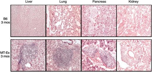 FIG. 2. Lymphocytic infiltrates are found in several tissues from MT-Exendin transgenic mice. Representative photomicrographs of tissues from 3-month-old L19 MT-Exendin (MT-Ex) and C57BL/6 (B6) wild-type control female mice stained with hematoxylin and eosin. Original magnification ×20.
