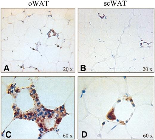 FIG. 1. Immunohistochemical detection of HAM 56+ macrophages in omental WAT (A and C) and subcutaneous WAT (B and D) of one representative obese woman. A: Macrophages are both dispersed into the omental WAT parenchyma and in crown arrangement (A, arrow heads). B: Only crown-like structures are visible in subcutaneous WAT parenchyma. Higher magnification (60×) of crown structures in omental WAT (C) and subcutaneous WAT (D). oWAT, omental WAT; scWAT, subcutaneous WAT.