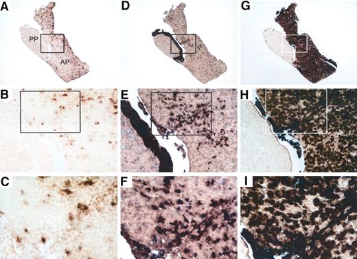 FIG. 3. Cellular distribution pattern of glucokinase mRNA in mouse pituitary as related to expression of ACTH/POMC and growth hormone (GH). RNA in situ hybridization studies are shown for glucokinase (A–C), ACTH/POMC (D–F), or GH (G–I). Images in A, D, and G were taken at 4×, in B, E, and H at 20×, and in C, F, and I at 40× magnification. Boxes indicate areas shown at higher magnification.