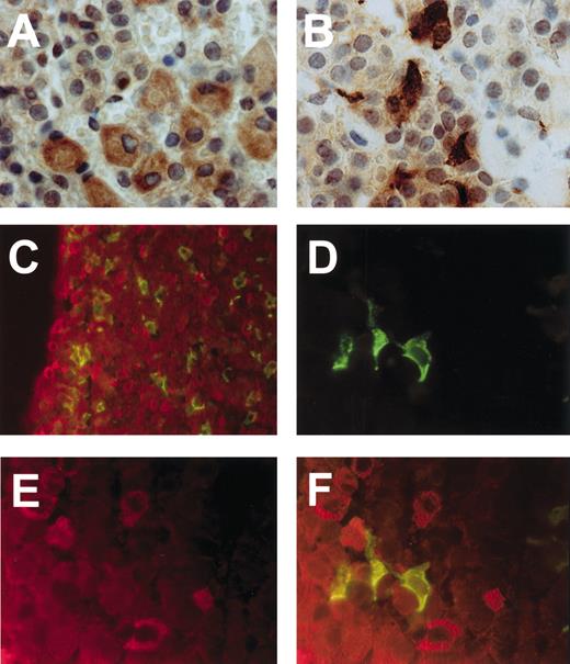 FIG. 4. Immunohistochemistry of glucokinase- and ACTH-expressing cells of the anterior pituitary lobe. The magnification of the images (40 or 100×) and the dilutions of the primary antibody (1:50 or 1:100) are given for each panel. A (100×): Immunoperoxidase stain for glucokinase (1:100). B (100×): Immunoperoxidase stain for ACTH (1:100). C (40×): Double staining with fluorescent antbodies against glucokinase (red; 1:50) and ACTH (green; 1:100) showing apparent lack of colabeling. D–F (100×): Fluorescent antibody stains of ACTH cells (D; 1:100), glucokinase-positive cells (E; 1:50), and fusion of D and E (F).