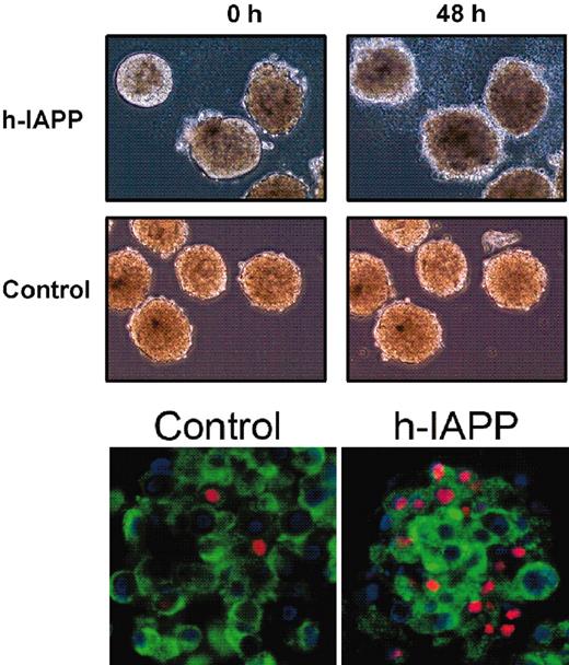 FIG. 1. Upper panels: Brightfield microscopic images (magnification ×100) of isolated islets in culture from nondiabetic human subjects before and after 48 h of incubation with and without h-IAPP (40 μmol/l). Note the expansion of the islet cross-sectional area and disintegration of the islet shape if islets were incubated with h-IAPP versus control. Lower panels: Representative immunofluorescent images of human islets (n = 120 and n = 125 for control and h-IAPP, respectively) similarly treated as above but subsequently fixed and immunostained for insulin (green) and apoptosis by TUNEL (red). Fixation and dehydration distorts islet architecture but increased apoptosis of β-cells and other cells types after exposure to h-IAPP is apparent.