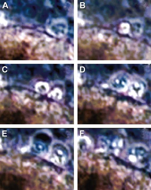 FIG. 3. Sections (10× zoom) from microscopic images (magnification 100×) of an isolated islet from a nondiabetic human subject. Images were acquired during 48 h of incubation with h-IAPP (40 μmol/l). The time interval between individual images is 20 min, starting at 15 h of incubation (A). A–F: Two cells appear at the islet surface and subsequently display morphological changes characteristic of apoptosis: cell shrinkage, fragmentation, and development of an apoptotic halo.