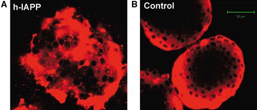 FIG. 5. Confocal micrographs showing representative human islets stained with DiI after 48 h of static incubation with 40 μmol/l (A) or without h-IAPP (B).