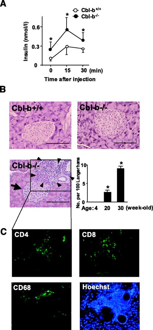FIG. 2. Plasma insulin levels and histochemical analysis of Langerhans’ islands in Cbl-b−/− mice. A: Serum insulin concentrations were determined in 30-week-old Cbl-b+/+ and Cbl-b−/− mice subjected to IPGTT. Mice underwent IPGTT, and blood samples were taken from the tail vein, as described in Fig. 1, for measurement of serum insulin levels by ELISA. Data are means ± SD (n = 7). *P < 0.05 compared with Cbl-b+/+ mice. B: The pancreas was dissected out from mice subjected to IPGTT, as described in the legend of Fig. 2A. Sections (3 μm thickness) from the pancreas of Cbl-b+/+ (top left panel) and Cbl-b−/− (top right panel) mice (30 weeks old) were stained with H&E. The number of Langerhans’ islands (indicated by the large arrow) infiltrated with mononuclear cells (indicated by arrowheads) in Cbl-b−/− pancreas was counted under high magnification (bottom left panel). The ratio of Langerhans’ islands infiltrated with mononuclear cells to normal ones (n = 100) was calculated in Cbl-b−/− mice at the indicated ages (bottom right panel). Similar results were obtained in three separate experiments. Data are means ± SD (n = 4/group/experiment). *P < 0.05 compared with 4-week-old Cbl-b−/− mice. Scale = 100 μm. C: Serial sections of the pancreas were immunostained with an anti-CD4, anti-CD8, and anti-CD68 antibody and Hoechst 33342, as indicated.