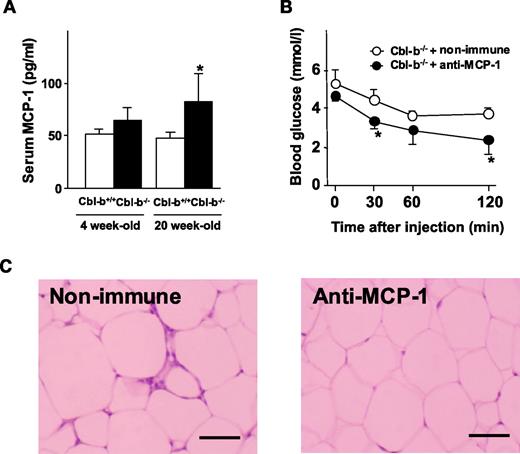 FIG. 7. Effects of anti–MCP-1 antibody on insulin resistance in Cbl-b−/− mice. A: Blood samples were prepared from Cbl-b+/+ and Cbl-b−/− mice of the indicated ages. Serum MCP-1 levels were determined by ELISA. Data are means ± SD (n = 7). *P < 0.05 compared with Cbl-b+/+ mice. B: Cbl-b−/− mice, intraperitoneally injected with an anti–MCP-1 IgG or nonimmune antibody, underwent IPITT. Blood glucose was measured at the indicated time after insulin injection. Data are means ± SD (n = 7). *P < 0.05 compared with nonimmune IgG treatment. C: Sections (3 μm thickness) from WAT of Cbl-b−/− mice injected with an anti–MCP-1 IgG or nonimmune antibody were stained with H&E. Similar results were obtained in four separate experiments, and representative images are shown. Scale = 50 μm.