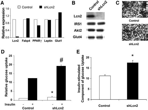 FIG. 5. shRNA-mediated knockdown of Lcn2 improves insulin action in cultured adipocytes. A: mRNA expression of Lcn2 and markers in mature 3T3-L1 adipocytes expressing either control shRNA or shLcn2. B: Protein expression of Lcn2 and other markers in mature 3T3-L1 adipocytes expressing either control shRNA or shLcn2. C: Oil red O staining of mature 3T3-L1 adipocytes expressing either control shRNA or shLcn2. D: Basal (□) and insulin-stimulated (▪) glucose uptake in mature 3T3-L1 adipocytes expressing either control shRNA or shLcn2. Data are means ± SD, n = 12, *P < 1e−5 relative to control shRNA, no insulin; #P = 5e−5 relative to control shRNA, plus insulin. E: Component of glucose uptake attributable to insulin, equivalent to the uptake in the presence of insulin minus the uptake in the absence of insulin. Data are means ± SD, n = 12, * P < 1e−4.