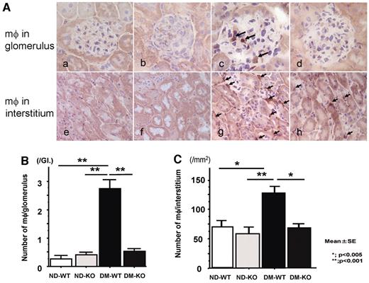 FIG. 4. A: Macrophage infiltration into the kidney. a–h: Macrophage (arrows) infiltration into glomeruli (c) and interstitium (g) was remarkable in diabetic SR-A+/+ mice (DM-WT), whereas it was minimal in diabetic SR-A−/− mice (DM-KO; d and h). a and e: Nondiabetic SR-A+/+ mice (ND-WT). b and f: Nondiabetic SR-A−/− mice (ND-KO). Original magnification ×400 (a–d) and ×200 (e–h). B: The number of intraglomerular macrophages. Data are means ± SE. **P < 0.001. C: The number of macrophages in interstitium. Data are means ± SE. *P < 0.005; **P < 0.001.