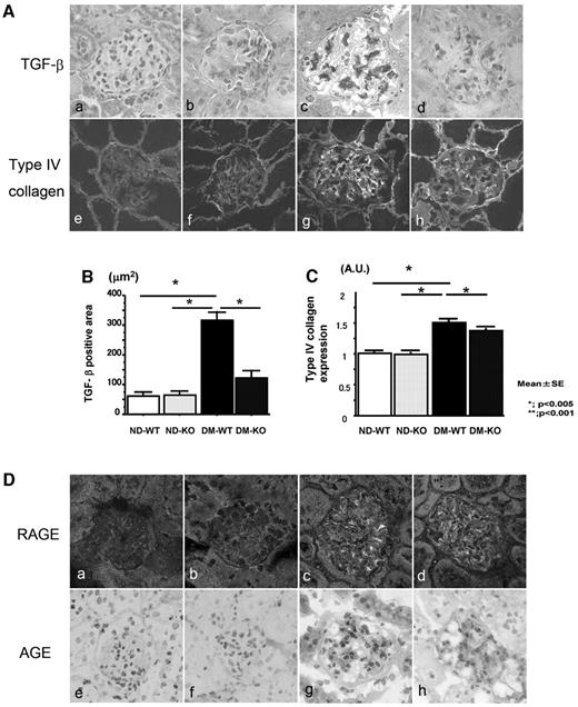 FIG. 5. A: Expression of TGF-β and type IV collagen in the kidney. a–d: TGF-β was prominent in the glomeruli of diabetic SR-A+/+ mice (DM-WT; c) compared with diabetic SR-A−/− mice (DM-KO; d). e–h: Type IV collagen was slightly increased in DM-WT (g) compared with DM-KO (h). a and e: nondiabetic SR-A+/+ mice (ND-WT). b and f: Nondiabetic SR-A−/− mice (ND-KO). Original magnification ×400. B: TGF-β–positive area in glomeruli. Data are means ± SE. *P < 0.005. C: Collagen IV–positive area in glomeruli (folds versus ND-WT). Data are means ± SE. *P < 0.005. D: Expression of RAGE and AGE (carboxymethyllysine) in the kidney (RAGE, a–d; AGE, e–h). RAGE and AGE expression was increased in both diabetic mice without significant difference. a and e, ND-WT; b and f, ND-KO; c and g, DM-WT; and d and h, DM-KO. Original magnification ×400.
