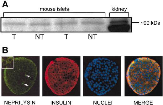 FIG. 1. A: Representative Western blot showing a band migrating at ∼90 kDa corresponding to neprilysin protein. Mouse islet proteins were extracted, subjected to SDS-PAGE, immunoblotted with a polyclonal rabbit anti-neprilysin antibody, and then visualized by enhanced chemiluminescence. Mouse kidney was used as a positive control (right lane). A smaller band, likely nonspecific, was present in kidney but not islets. Each lane represents islet lysate from one female mouse. NT, nontransgenic; T, hIAPP transgenic. B: Representative islets from a hIAPP transgenic mouse stained for neprilysin (green), insulin (red), and nuclei (blue). Neprilysin appears to be localized to both β-cells and non-β-cells, as seen in the merge, and is membranous/cytoplasmic, as seen in the insert. In a subpopulation of islet cells, neprilysin staining is more intense (arrows). An identical pattern was seen in nontransgenic islets.