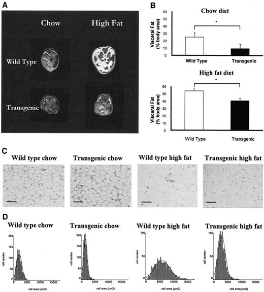 FIG. 4. Changes in adiposity in response to high-fat feeding in wild-type and IGFBP-2 transgenic mice. A and B: Visceral fat was assessed by MRI in mice receiving chow or high-fat diet for 32 weeks (n = 3). C: Representative sections of perigonadal fat after 32 weeks of feeding (initial magnification ×10; bar = 50 μm). D: Adipocyte area in histological sections of perigonadal fat after 32 weeks of feeding. *P < 0.05, n = 6 per group.