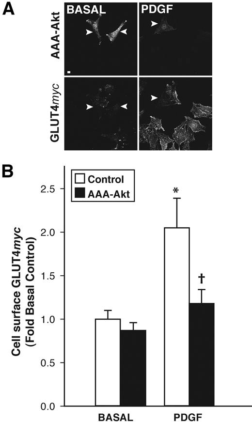 FIG. 1. Kinase-inactive Akt (AAA-Akt) abolishes PDGF-induced gain in cell-surface GLUT4myc in L6 myoblasts. L6 GLUT4myc myoblasts were transiently transfected with HA-AAA-Akt, then serum deprived and left unstimulated (BASAL) or stimulated with 50 ng/ml PDGF (7 min). Cell-surface GLUT4myc content was measured by detection of anti-myc antibody immunoreactivity in fixed nonpermeabilized cells using confocal fluorescence microscopy and quantified with ImageJ software, as described in research design and methods. Transfected cells were identified following permeabilization with 0.1% Triton-X100 and incubation with anti-HA antibody. A: Representative immunofluorescence images (collapsed xy projections) of five independent experiments (25–76 cells per condition) showing surface GLUT4myc content (bottom panels) in untransfected cells (control) versus cells transfected (indicated by arrowheads) with AAA-Akt (top panels). B: Quantification of cell-surface GLUT4myc content. Data are means ± SE and are expressed relative to the values in basal control cells. *P < 0.05 vs. basal control; †P < 0.05 vs. control (within treatment). Scale bar, 10 μm.