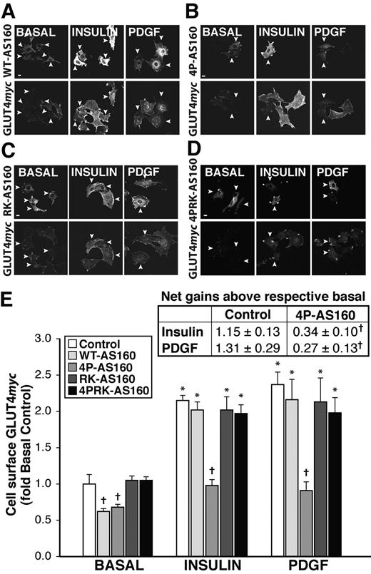 FIG. 3. Increased surface GLUT4myc elicited by insulin or PDGF in L6 myoblasts is reduced by 4P-AS160. Serum-deprived L6 GLUT4myc myoblasts transfected with the indicated constructs were left unstimulated (BASAL) or stimulated with either 100 nmol/l insulin (10 min) or 50 ng/ml PDGF (7 min). Cell-surface GLUT4myc content and transfected cells were detected as described in research design and methods A–D: Representative immunofluorescence images (collapsed xy projections) of surface GLUT4myc (bottom panels) in untransfected cells (control) versus cells transfected (indicated by arrowheads) with WT-AS160, 4P-AS160, RK-AS160, or 4PRK-AS160 (top panels). E: Quantification of cell-surface GLUT4myc content from 5 to 12 independent experiments (>100 cells per condition). Data are means ± SE and are expressed relative to the values in basal control cells. Table (inset) shows means ± SE of the net gain in surface GLUT4myc subtracted from the respective basal values. *P < 0.05 vs. basal control; †P < 0.05 vs. control (within treatment). Scale bar, 10 μm.
