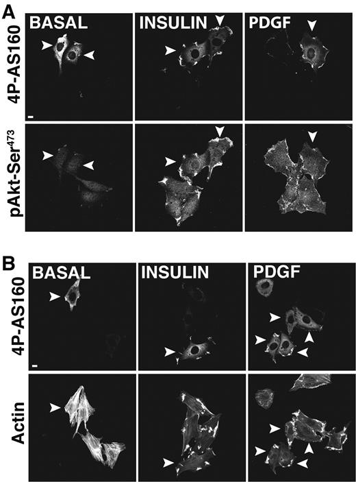 FIG. 4. 4P-AS160 does not affect insulin or PDGF-stimulated Akt Ser473 phosphorylation and actin remodeling in response to insulin or PDGF in L6 myoblasts. L6 GLUT4myc myoblasts were transfected with the indicated constructs, then serum deprived and left unstimulated (BASAL) or stimulated with either 100 nmol/l insulin (10 min) or 50 ng/ml PDGF (7 min). Akt Ser473 phosphorylation and filamentous actin were assessed by confocal fluorescence microscopy with an immunohistochemistry compatible anti–Akt Ser473 antibody and rhodamine-phallodin, respectively. Cells transfected (indicated by arrowheads) with 4P-AS160 (top panels) were identified as described in research design and methods. Shown are composite images of Akt Ser473 phosphorylation (A; collapsed xy projections, bottom panels) and actin remodeling (B; dorsal plane, bottom panels) of three independent experiments (30–60 cells per condition). Scale bar, 10 μm.
