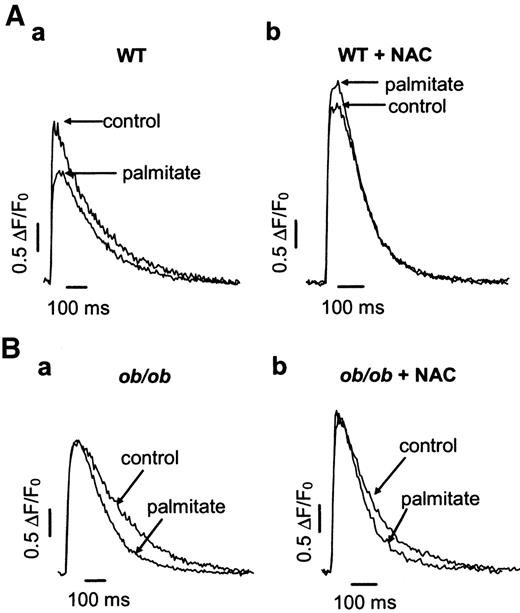 FIG. 1. Representative spatially averaged Ca2+ transients (expressed as normalized fluo-3 fluorescence) from a wild-type (WT) (A) and an ob/ob (B) cardiomyocyte. Transients were obtained in the absence (a) and presence (b) of NAC (20 mmol/l) and during exposure to palmitate (1.2. mmol/l) as indicated.