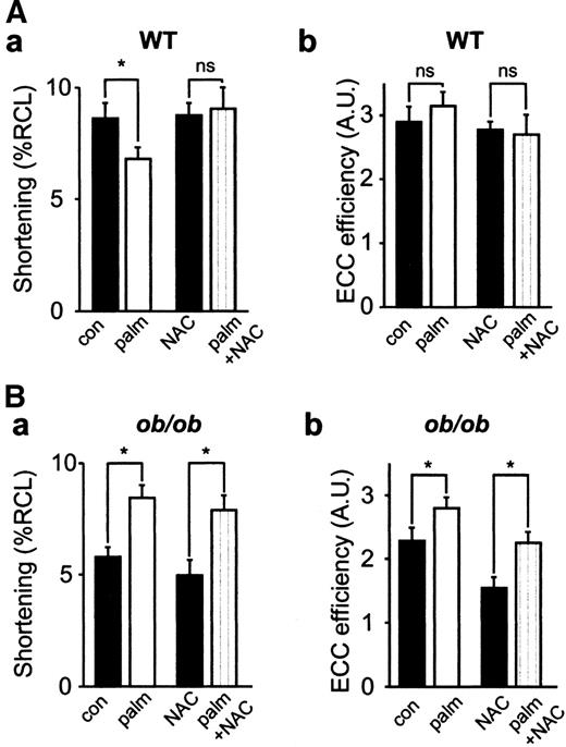 FIG. 2. Palmitate improved contractile function of ob/ob cardiomyocytes. Mean data (± SE; n = 10–16 cells) of cell shortening (a) and ECC efficiency (b) in wild-type (WT) (A) and ob/ob (B) cells. Cell shortening is as a percentage of the resting cell length (RCL) and ECC efficiency is the ratio between the relative cell shortening and the Ca2+ transient amplitude. NAC (20 mmol/l) and palmitate (1.2 mmol/l) exposure as indicated. *Statistical difference between the absence and presence of palmitate (P < 0.05).