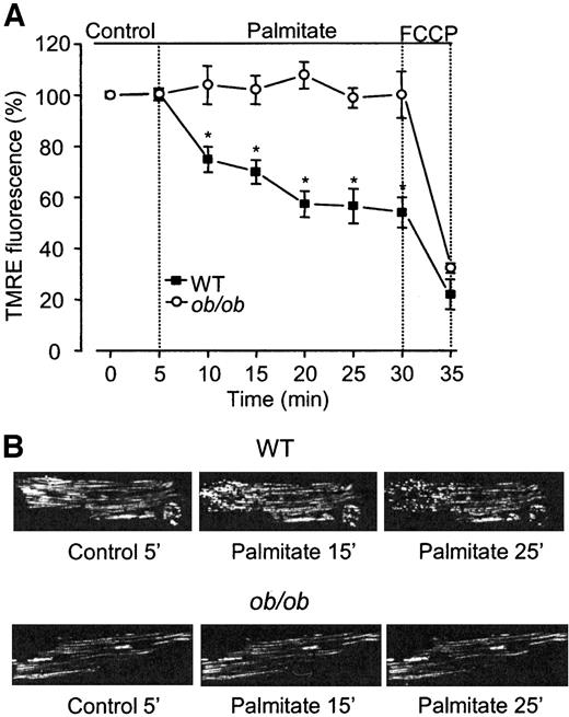 FIG. 4. Palmitate dissipated ΔΨm in wild-type but not in ob/ob cardiomyocytes. A: The normalized TMRE fluorescence recorded under control conditions, during 25 min with 1.2 mmol/l palmitate, and finally after 5 min in 1 μmol/l FCCP. Data are means ± SE from 16 to 25 cells; ▪, wild-type (WT); ○, ob/ob. *Statistical difference between the two groups (P < 0.05). B: Typical images of a wild-type (WT) (upper row) and an ob/ob (lower row) cell. Images were obtained after 5 min under control conditions and after 15 and 25 min in the presence of palmitate. Note the marked palmitate-induced decrease in fluorescent light (reflecting a decreased ΔΨm) in the wild-type cell.