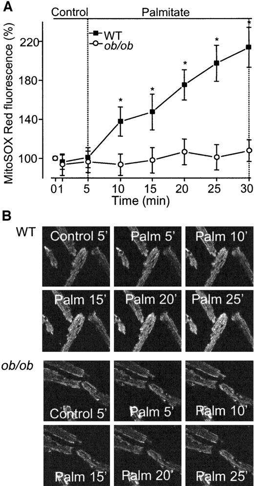 FIG. 5. Palmitate increased the mitochondrial ROS production in wild-type but not in ob/ob cardiomyocytes. A: The normalized MitoSOX Red fluorescence recorded under control conditions and during 25 min with palmitate. Data are means ± SE from 10 cells in each group. ▪, wild-type (WT); ○, ob/ob. *Statistical difference between the two groups (P < 0.05). B: Typical images of wild-type (WT) (upper panel) and ob/ob (lower panel) cells. Images obtained after 5 min under control conditions and at 5-min intervals in the presence of palmitate. Note the marked palmitate-induced increase in fluorescent light (reflecting increased ROS) in the wild-type cells.