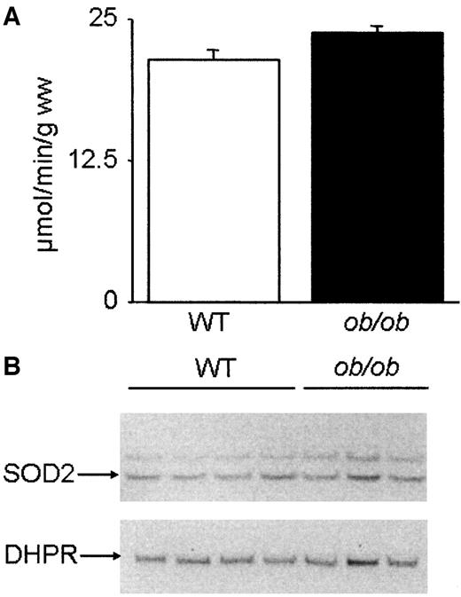 FIG. 6. No difference in aconitase activity or SOD2 expression between wild-type and ob/ob hearts. A: Mean data (±SE; n = 4) of aconitase activity in wild-type (WT) (▪) and ob/ob (□) hearts. B: SOD2 and dihydropyridine receptor (DHPR) immunoblots of wild-type (WT) and ob/ob hearts as indicated. Note that the expression of SOD2 was similar in the two groups. A total of 30 μg total protein was loaded into each well, and DHPR was used as a control for equal loading.