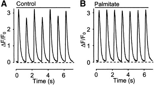FIG. 7. Typical records of cytosolic Ca2+ transients in an ob/ob cardiomyocyte in the absence (A) and presence (B) of palmitate (1.2 mmol/l). Note that this cell displayed Ca2+ alternans that disappeared during palmitate exposure.
