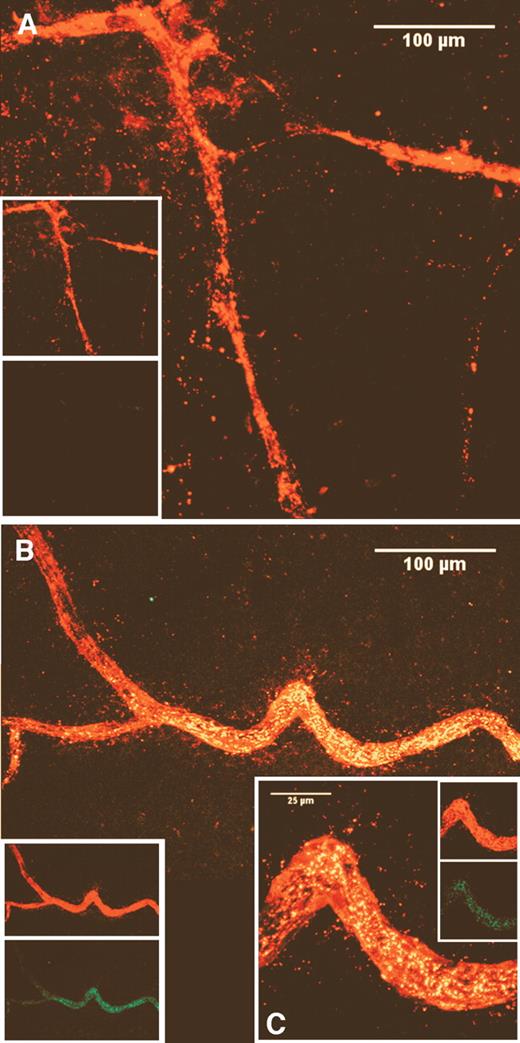 FIG. 1. Injection of huCD34+ cells within the vitreous results inreendothelialization of damaged vessels in the mouse model of OIR. Green-labeled huCD34+ cells were administered to mouse pups (n = 8) on P12 and eyes harvested at P14. Images are z-series projections of two-color LSCM. Panel A depicts the central region of a retina from a mouse that did not receive huEPC, and shows expected pathology, including lack of microvessels and degenerate larger vessels. Panel B depicts a similar region of a retina from a mouse eye that was injected with huEPC. Note the high degree of incorporation of labeled cells into the dilated and functioning vessel (yellow). Inset panel C is a higher magnification of a portion of the vessel in panel B. The other insets show separate red and green channels used to make the composite images.