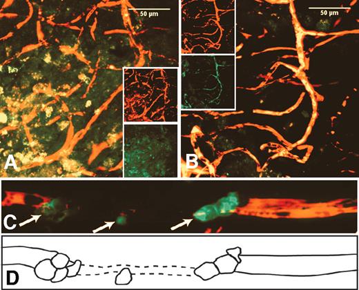 FIG. 2. huEPC of nondiabetic, but not diabetic, origin integrate into degenerate vasculature in mouse eyes damaged by I/R injury (n = 20). huCD34+ cells were given by intravitreous injection (n = 10) or systemically (n = 10) 7 days after I/R injury. Two days later, animals were killed and perfused with rhodamine-conjugated dextran to examine vessel patency. Cells of diabetic origin (panel A) do not integrate into existing vasculature, whereas cells of nondiabetic origin (panel B) show extensive integration into small and medium sized vessels (yellow in the composite images). Images are z-series projections of two-color LSCM. Insets show separate red and green channels used to make the composite images. In panel C CD34+ cells home to an area of injury and traverse toward the ischemic region of the capillary (arrows). Panel D is a schematic representation of the image in panel C and depicts the nonperfused/acellular region as a hatched line in order to better visualize the process.