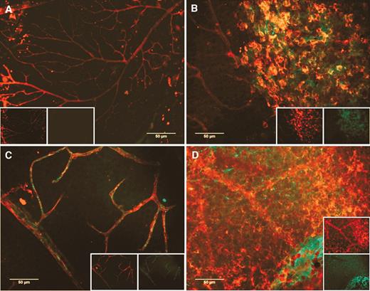 FIG. 3. Normal huEPC, but not diabetic huEPC, participate in ocular vascular reendothelialization in STZ-diabetic mice. All images are composite red and green channels (shown in respective insets) of epifluorescence digital captures of representative neural retinas. STZ-diabetic (n = 12) and age- and sex-matched normal control mice (n = 12) were given labeled huCD34+ cells from either diabetic (n = 6 diabetic mice, n = 6 nondiabetic mice) or nondiabetic donors (n = 6 diabetic mice, n = 6 nondiabetic mice), and eyes were harvested 48 h later. Panel A is from a normal mouse that received nondiabetic cells. Lack of vascular injury should preclude incorporation of labeled EPC. Note the lack of labeled cells. Panel B is from a normal mouse that received diabetic huEPC. Note the tendency for these labeled cells to form clumps distinct from the vasculature. By contrast, panel C shows extensive incorporation of labeled CD34+ cells from a normal donor in damaged vasculature of a STZ-diabetic mouse. Panel D demonstrates that huEPC incorporation is not solely a function of vascular damage in the recipient, since labeled diabetic CD34+ cells do not integrate into vasculature of a STZ-diabetic mouse, but rather form sheets and clumps separate from the vascular plexus.