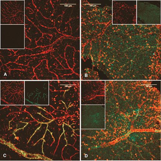 FIG. 4. huCD34+ EPC of nondiabetic, but not diabetic, origin integrate into damaged vasculature in BBZ/Wor diabetic rats. Labeled cells were given by intravitreous injection to immune suppressed rats (n = 6 nondiabetic rats/nondiabetic EPC; n = 6 nondiabetic rats/diabetic EPC; n = 6 diabetic rats/nondiabetic EPC; n = 6 diabetic rats/diabetic EPC). All images are z-series projections of two-color LSCM, with insets showing respective separate red and green channels. Panel A is from a healthy rat receiving nondiabetic huEPC. Note the lack of labeled cells consistent with lack of vascular injury. Panel B shows that diabetic huEPC in a normal rat eye form a discrete layer without integrating into vessels. Panel C demonstrates clear reendothelialization by labeled normal huEPC into presumably damaged vasculature of a diabetic rat. Panel D shows again that diabetic EPC are incapable of integrating into damaged vasculature, instead forming distinct clumps and layers separate from vessels.