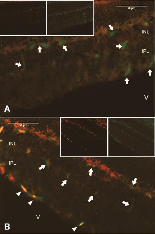FIG. 5. EPC integrate into damaged vessel walls and are not merely associated perivascularly with vessels. Two-color fluorescent immunohistology of frozen sections of mouse eyes with intravitreous huEPC shows green mouse endothelial cells (arrows) in the superficial, middle, and deep vascular plexi of the neural retina of both normal control (n = 4) (panel A) and STZ-diabetic (n = 4) (panel B) mice. However, only in the diabetic mouse eye in panel B are there red huEPC (arrowheads), which align with the mouse endothelium. V = vitreous; INL = inner nuclear layer; IPL = inner plexiform layer.