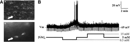 FIG. 5. A: A NPY-GFP neuron (white arrow) visualized with ×40 objective under (a) infrared and (b) fluorescent light. B: Whole-cell current-clamp recording of an ARC NPY neuron to altered glucose concentration.