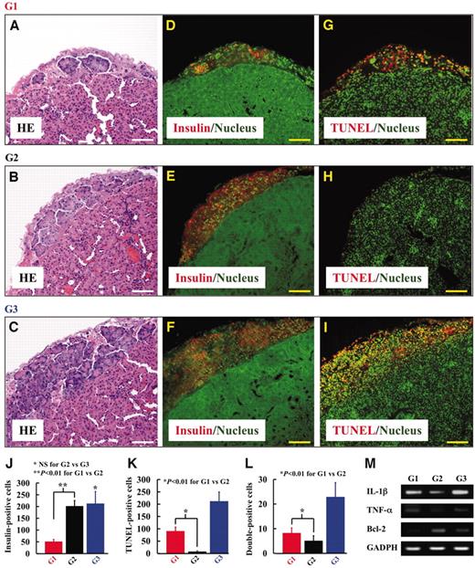 FIG. 3. Histological study of islets transplanted into the subrenal capsule in diabetic mice at 3 days. A–C (hematoxylin and eosin staining): A few clusters of islets were found in the graft of V5-untreated 150 islet equivalents (group 1: obtained from one donor), but much larger clusters were detected in that of V5-treated 150 islet equivalents (group 2: obtained from one donor). Amounts of islets were found in the graft of V5-untreated 450 islet equivalents (group 3: obtained from three donors), which served as a positive control. D–F (insulin staining): A few insulin-expressing cells, indicated by a red signal, were observed in the group 1 graft; in contrast, the group 2 graft showed significantly more insulin-positive cells, in which insulin intensity was stronger than in the cells in the group 3 graft. The observation was confirmed by counting the cell numbers of 10 different sections of each sample (n = 3) (J). The number of insulin-positive cells was 51.3 ± 8.7 for group 1, 202.1 ± 23.4 for group 2, and 212.5 ± 51.1 for group 3. G–I (TUNEL staining): Significantly higher ratios of TUNEL-positive cells, indicated by a red signal, were observed in the grafts of groups 1 and 3 compared with the group 2 graft. K: The number of TUNEL-positive cells was counted in 10 different sections of each sample (n = 3), and it was 91.2 ± 15.7 cells for group 1, 8.1 ± 3.1 for group 2, and 211.7 ± 37.6 for group 3. Scale bars = 200 μm. L: The number of double- (TUNEL- and insulin-) positive cells was counted in 10 different sections of each sample (n = 3), and it was 8.3 ± 2.0 cells for group 1, 5.1 ± 2.0 for group 2, and 22.9 ± 5.8 for group 3. Scale bars = 200 μm. M: V5 treatment significantly depressed inflammatory molecule IL-1β and TNF-α gene expression and enhanced Bcl-2 expression in islet grafts 2 days after transplantation.