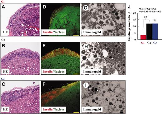 FIG. 5. Histological study of islets transplanted into the subrenal capsule in diabetic mice at 6 months. A–C (HE staining): Quite a few clusters of islets were found in the group 1 graft, but islet clusters were properly maintained in the group 2 graft, which was comparable with those in group 3 islets. Scale bars = 200 μm. D–F (insulin staining): Significantly more insulin-positive cells were observed in the group 2 graft than in the group 1 graft, which were comparable with the group 3 graft. Scale bars = 200 μm. G–J (transmission electron microscopy–immunogold staining): Numerous insulin secretory granules and well-preserved ultrastructural organelles were observed in the group 2 graft (12.0 ± 1.2 granules/field) when the grafts of group 1 (3.4 ± 0.09) and group 3 (12.0 ± 1.5) were considered. Such insulin granules were present in the apical zone of the β-cells in the group 2 graft. Black arrows indicate the insulin secretory granules labeled by immunogold, and white arrows show the glucagons granules (J). Scale bars = 300 nm. These data are representative of three different samples.