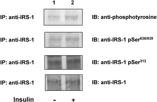 FIG. 5. Immunoprecipitation and immunoblot analysis of homogenates of biopsies of vastus lateralis muscle taken 1 h before (lane 1) and at the end of 2 h of insulin infusion (lane 2) during a euglycemic-hyperinsulinemic clamp in a representative healthy control subject. Muscle homogenates (1 mg protein for anti-pSer636/639, anti-pSer312, and anti-phosphotyrosine; 0.3 mg for total IRS-1 protein) were immunoprecipitated using anti–IRS-1 antibody as described in the text. Immunoprecipitated proteins were resolved on SDS-polyacrylamide gels, and the proteins were transferred electrophoretically to nitrocellulose membranes. The membranes were exposed to antiphosphotyrosine (upper panel), anti–IRS-1 pSer636/639 (second panel), anti–IRS-1 pSer312 (third panel), or anti–IRS-1 protein (lower panel) antibodies and visualized by chemiluminescence.