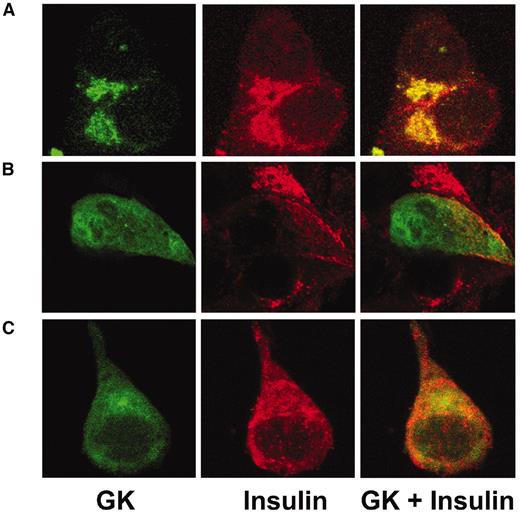 FIG. 3. Subcellular location of GFP-tagged GK chimeras in MIN6. A: Untreated MIN6 cells were fixed and immunostained for GK (fluorescein isothiocyanate green) and insulin (Texas Red). B: MIN6 cells transiently transfected with GFP GK (green) immunostained for insulin (red). C: Stable GFP GK (green) cells immunostained for insulin (red). Yellow staining indicates colocalization.